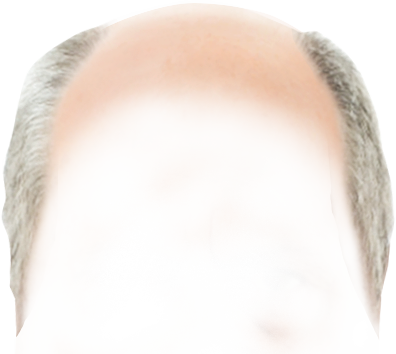 el