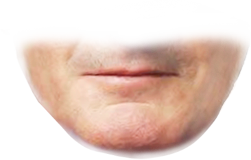 el